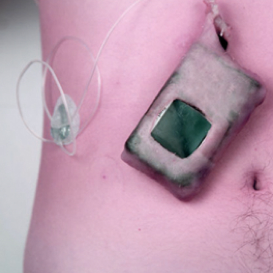 Aesthetics of Health Care Technologies